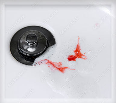 Are you seeing blood in the sink?